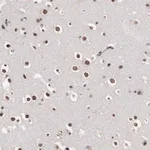 Merck Anti-OTX2 antibody produced in rabbit