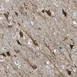 Merck Anti-JADE3 antibody produced in rabbit