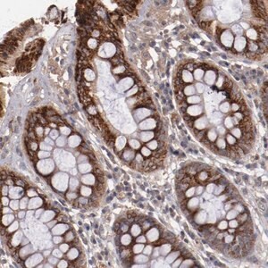 Merck Anti-CXorf36 antibody produced in rabbit