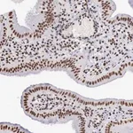 Merck Anti-DKC1 antibody produced in rabbit