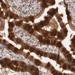 Merck Anti-PLEKHA1 antibody produced in rabbit