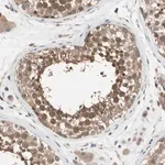 Merck Anti-DPP8 antibody produced in rabbit
