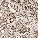 Merck Anti-PNPLA6 antibody produced in rabbit