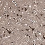 Merck Anti-PPP1R13B antibody produced in rabbit