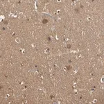 Merck Anti-PNCK antibody produced in rabbit