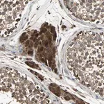 Merck Anti-POLRMT antibody produced in rabbit
