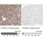 Merck Anti-PPFIBP2 antibody produced in rabbit