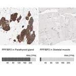 Merck Anti-PPFIBP2 antibody produced in rabbit