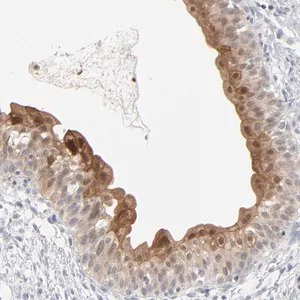 Merck Anti-POF1B antibody produced in rabbit
