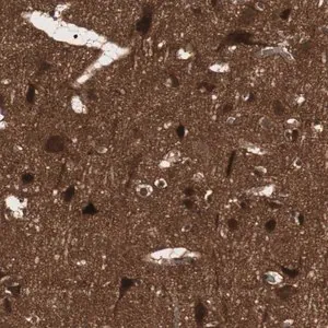 Merck Anti-PRKG2 antibody produced in rabbit