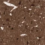 Merck Anti-PRKG2 antibody produced in rabbit