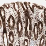 Merck Anti-PPP2R5E antibody produced in rabbit