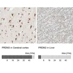 Merck Anti-PRDM2 antibody produced in rabbit