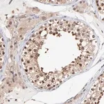 Merck Anti-PSMA6 antibody produced in rabbit