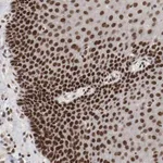 Merck Anti-ETV3 antibody produced in rabbit