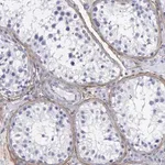 Merck Anti-FBLN5 antibody produced in rabbit