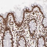 Merck Anti-FBXO18 antibody produced in rabbit