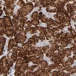 Merck Anti-FANCB antibody produced in rabbit