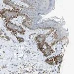 Merck Anti-NPHP3 antibody produced in rabbit