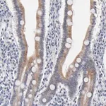 Merck Anti-AADAC antibody produced in rabbit
