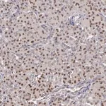 Merck Anti-GRK3 antibody produced in rabbit