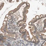 Merck Anti-SMG1 antibody produced in rabbit