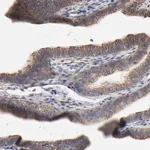 Merck Anti-ABCD4 antibody produced in rabbit