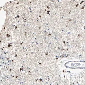 Merck Anti-ADAMTS5 antibody produced in rabbit
