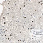 Merck Anti-ADAMTS5 antibody produced in rabbit