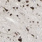Merck Anti-AATF antibody produced in rabbit