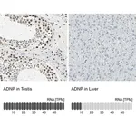 Merck Anti-ADNP antibody produced in rabbit