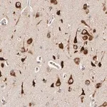Merck Anti-FKBP3 antibody produced in rabbit
