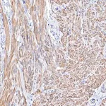 Merck Anti-TPM1 antibody produced in rabbit