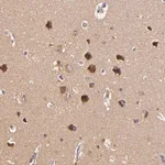 Merck Anti-TOM1 antibody produced in rabbit