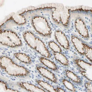 Merck Anti-GALNT5 antibody produced in rabbit