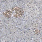 Merck Anti-GBA antibody produced in rabbit