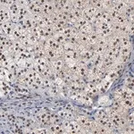 Merck Anti-FOXN2 antibody produced in rabbit