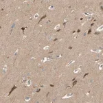 Merck Anti-ALK antibody produced in rabbit