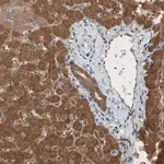 Merck Anti-ALDH9A1 antibody produced in rabbit