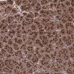 Merck Anti-TRIP11 antibody produced in rabbit