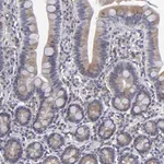 Merck Anti-TMX1 antibody produced in rabbit