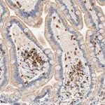 Merck Anti-UCKL1 antibody produced in rabbit
