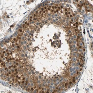 Merck Anti-USP13 antibody produced in rabbit