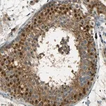 Merck Anti-USP13 antibody produced in rabbit