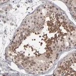 Merck Anti-GLCCI1 antibody produced in rabbit