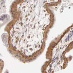 Merck Anti-UPF3B antibody produced in rabbit