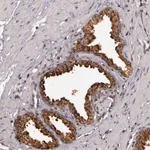 Merck Anti-GLIS1 antibody produced in rabbit