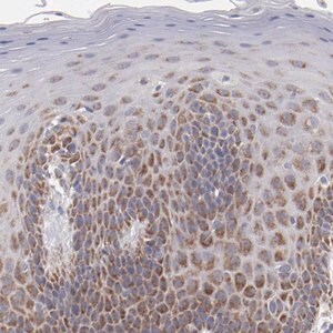 Merck Anti-HCCS antibody produced in rabbit