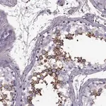 Merck Anti-SLC2A3 antibody produced in rabbit
