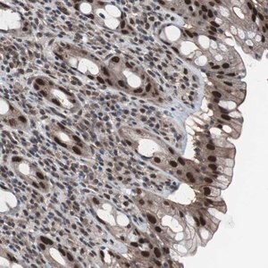 Merck Anti-GTF2F2 antibody produced in rabbit